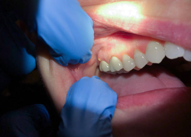 Best Emergency Pediatric Dental Care in Conway Springs, KS
