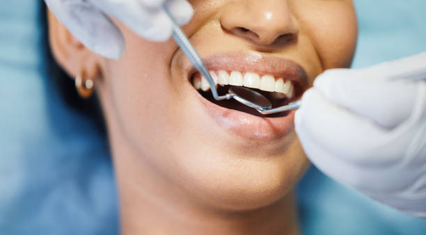 Best Broken or Chipped Tooth Repair in Conway Springs, KS